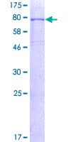 Human ALK2 / ACVR1 Protein (Recombinant GST)