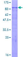 Human ACVR2 / ACVR2A Protein (Recombinant GST)