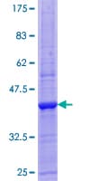 Human ALCAM / CD166 Protein (Recombinant GST)