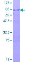 Human ALDH1A1 / ALDH1 Protein (Recombinant GST)