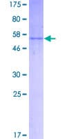 Human KLK3 / PSA Protein (Recombinant GST)