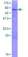 Human ALDH7A1 Protein (Recombinant GST)