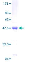 Human BAX Protein (Recombinant GST)