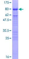 Human CDC25C Protein (Recombinant GST)
