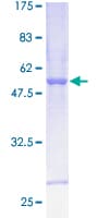 Human CS / Citrate Synthase Protein (Recombinant GST)
