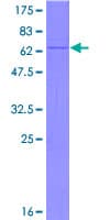 Human CS / Citrate Synthase Protein (Recombinant GST)