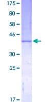 Human CSF2 / GM-CSF Protein (Recombinant GST)