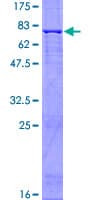Human CSF2RA / CD116 Protein (Recombinant GST)