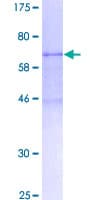 Human CXADR Protein (Recombinant GST)