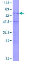 Human CXADR Protein (Recombinant GST)