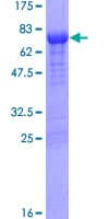 Human TP / Thymidine Phosphorylase Protein (Recombinant GST)