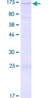 Human EPHB4 / EPH Receptor B4 Protein (Recombinant GST)