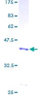 Human FABP1 / L-FABP Protein (Recombinant GST)