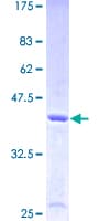 Human E-FABP / FABP5 Protein (Recombinant GST)