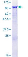 Human GCLC Protein (Recombinant GST)