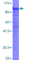 Human ITGB2 / CD18 Protein (Recombinant GST)