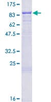 Human ITGB2 / CD18 Protein (Recombinant GST)