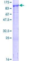 Human LIMK2 Protein (Recombinant GST)