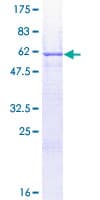 Human EPCAM Protein (Recombinant GST)