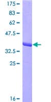Human MIF Protein (Recombinant GST)