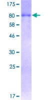 Human SQSTM1 Protein (Recombinant GST)