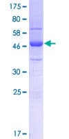 Human SFI1 Protein (Recombinant GST)