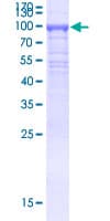 Human KLHL21 Protein (Recombinant GST)
