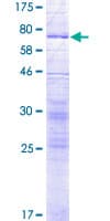 Human SLC17A4 Protein (Recombinant GST)