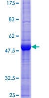 Human EBI3 / IL-27B Protein (Recombinant GST)
