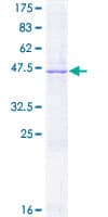 Human PROCR / EPCR Protein (Recombinant GST)