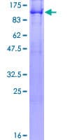 Human RIP1 / RALBP1 Protein (Recombinant GST)