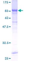 Human RIPK3 / RIP3 Protein (Recombinant GST)
