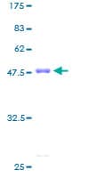Human GCL / Grancalcin Protein (Recombinant GST)