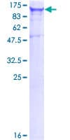 Human EIF2AK1 Protein (Recombinant GST)