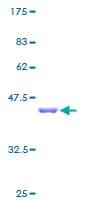 Human PHPT1 Protein (Recombinant GST)