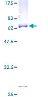 Human ST6GALNAC6 Protein (Recombinant GST)