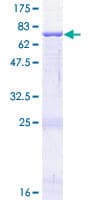Human CD209 / DC-SIGN Protein (Recombinant GST)
