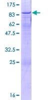 Human UTP18 Protein (Recombinant GST)