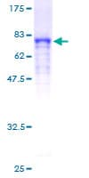 Human DNAJA4 Protein (Recombinant GST)