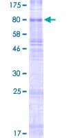 Human SLC22A11 Protein (Recombinant GST)