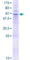 Human SLC25A40 Protein (Recombinant GST)