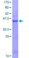 Human C1QDC1 / Caprin-2 Protein (Recombinant GST)