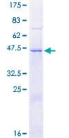 Human DCAKD Protein (Recombinant GST)