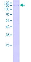 Human MCM8 Protein (Recombinant GST)