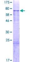 Human PAPD4 Protein (Recombinant GST)