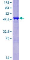 Human LOC285141 Protein (Recombinant GST)
