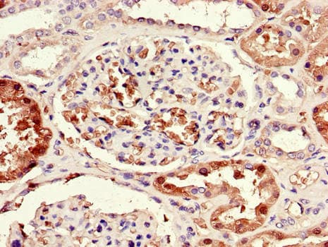 Polyclonal Rabbit anti-Human SORD / Sorbitol Dehydrogenase Antibody (IHC)