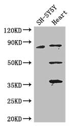 Polyclonal Rabbit anti-Human MAPT / Tau Antibody (IHC, IF, WB)