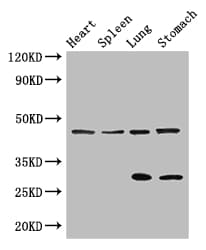 Polyclonal Rabbit anti-Human REN / Renin 1 Antibody (IF, WB)