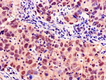 MYBL2 Antibody